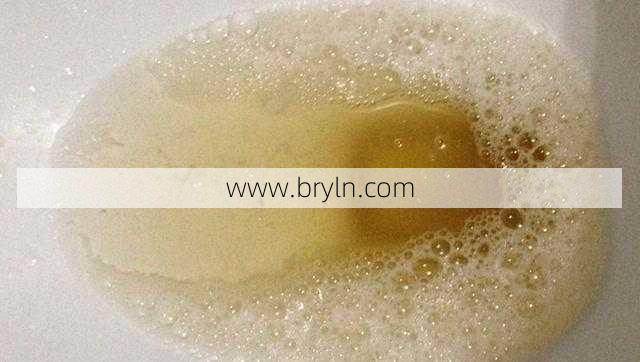 尿液里有气泡(尿液有气泡是怎么回事？排尿出现4种异常不可大意，小心是肾病)