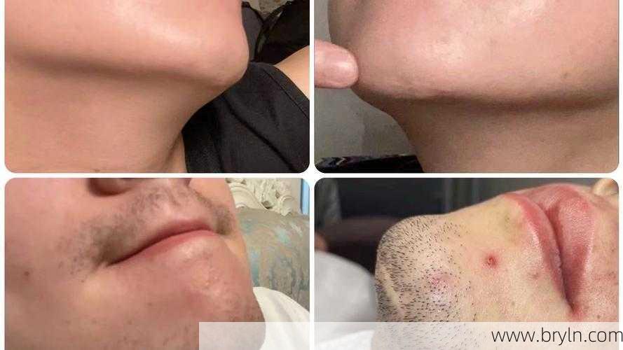 男生脱毛(小伙子去脱毛，发生了蹊跷的事情？)