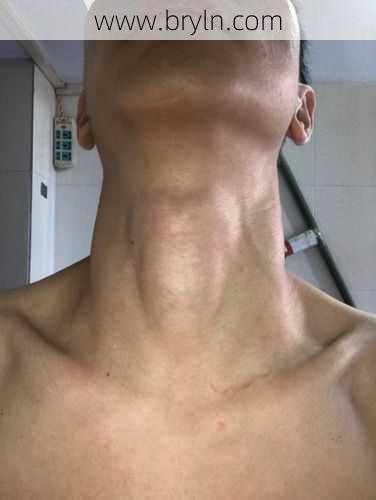 喉结不明显()