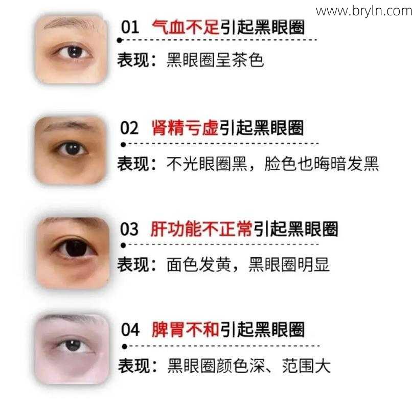 黑眼圈的原因()