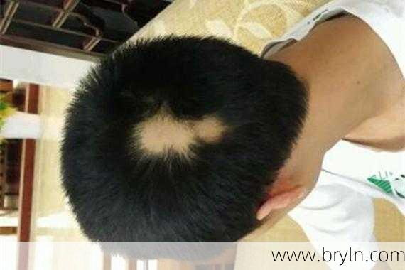 鬼剃头是怎么回事(