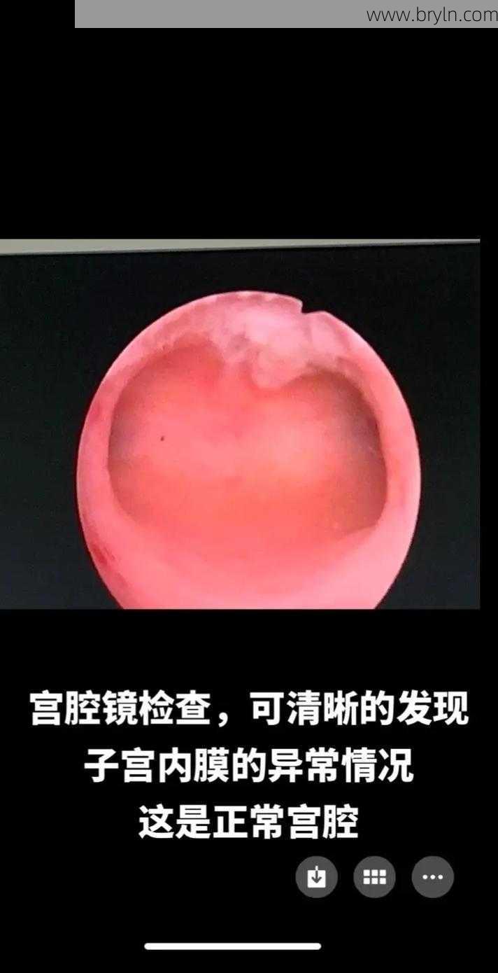 宫腔镜是什么检查()