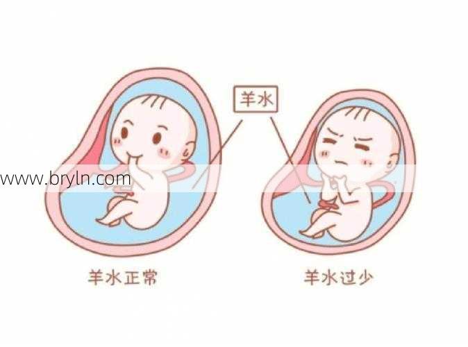 孕妇羊水少怎么办()
