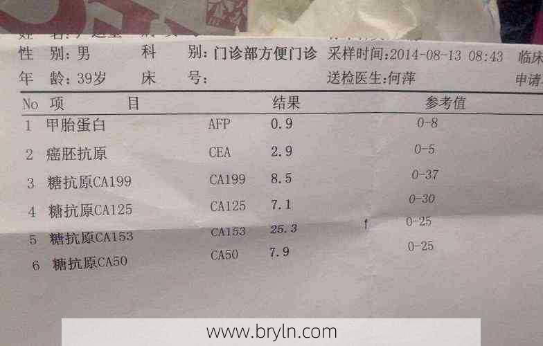 ca125是什么()