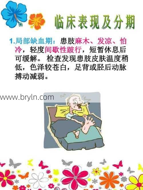 动脉硬化的症状表现及日常护理相关知识