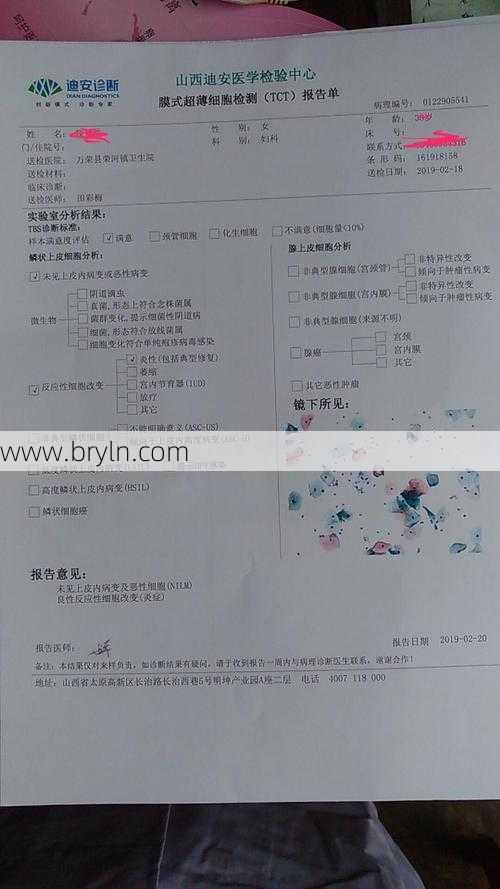 tct是什么意思()