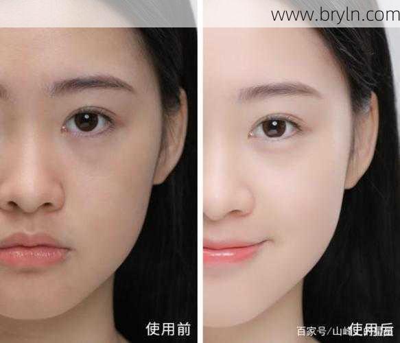 暗黄皮肤如何美白()