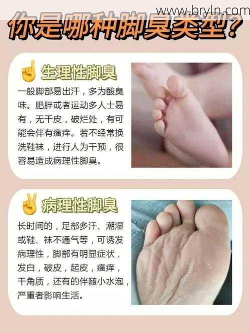 脚臭怎么回事(脚好臭啊，到底是怎么回事，如何根治脚臭)