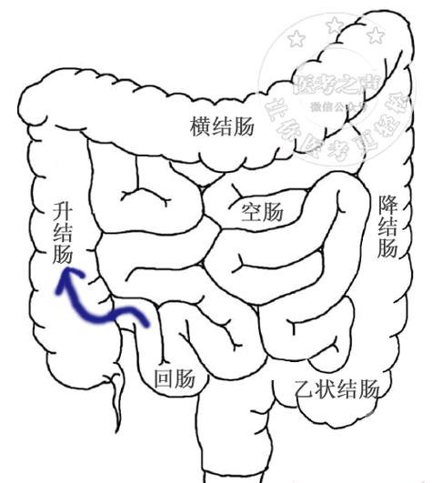 肠结核的症状(肠结核会传染吗？会传染，4个表现是“警示”)