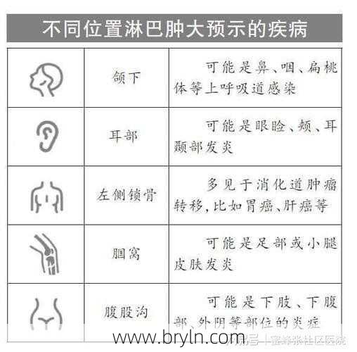 淋巴结挂什么科(淋巴肿了，疼比不疼好！危险的淋巴结有这几个特点)