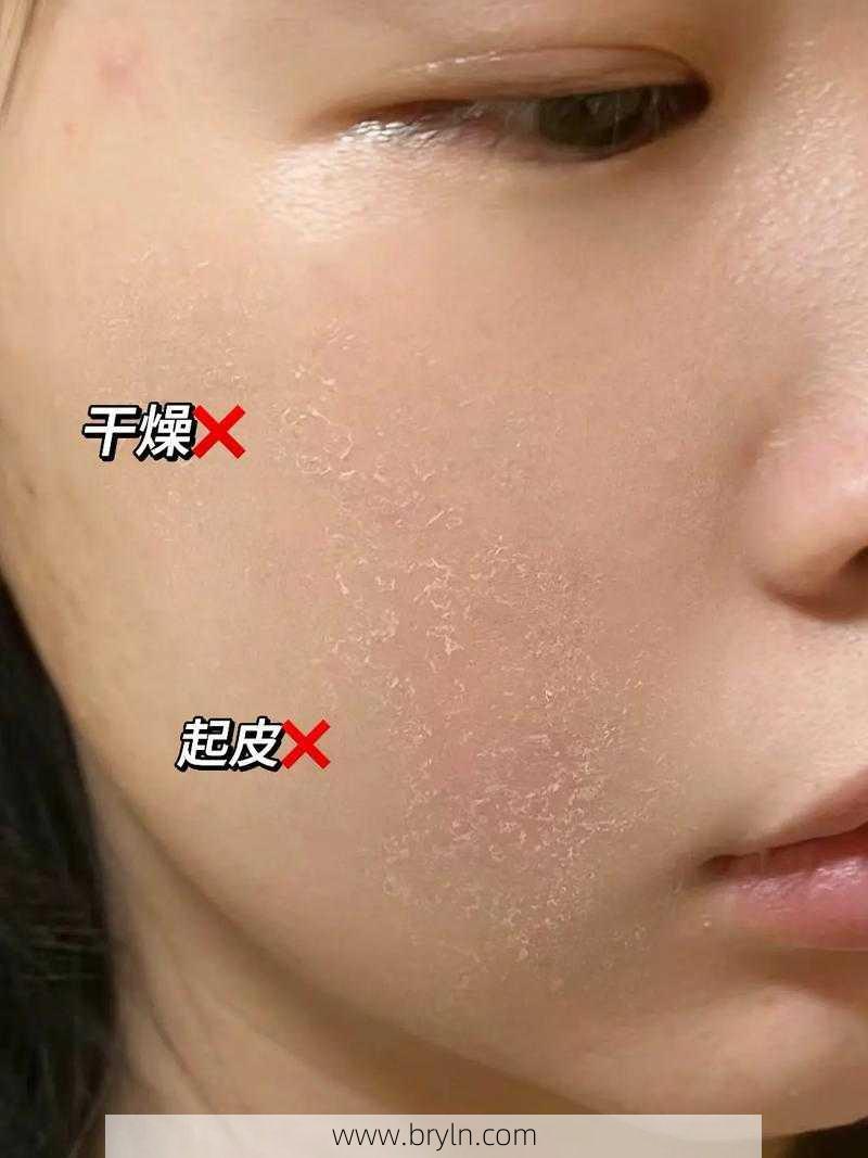 脸上起皮怎么回事(脸上起皮是怎么回事)