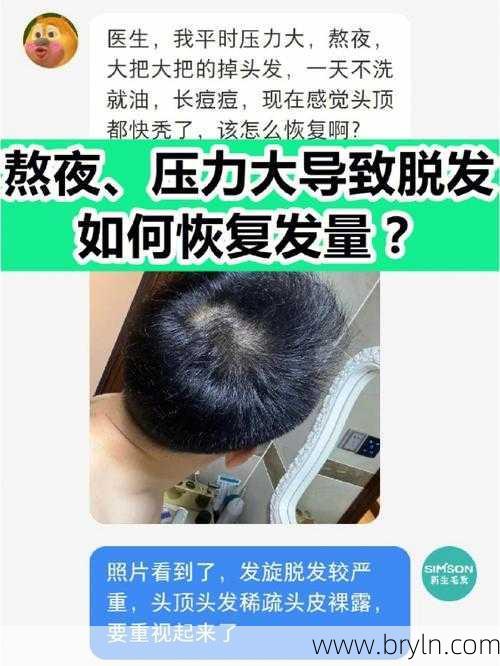 熬夜脱发怎么恢复(熬夜脱发怎么办？教你快速补救法)